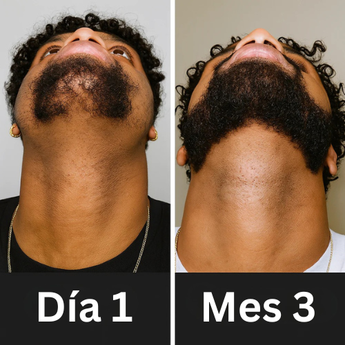 Avio™ Serum de Crecimiento Capilar y Barba