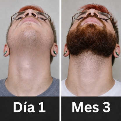 Avio™ Serum de Crecimiento Capilar y Barba